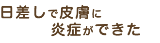 日差しで皮膚に炎症ができた